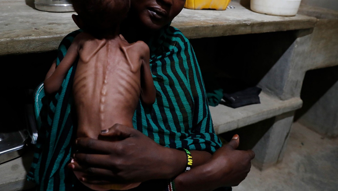 Malnourished children in Sudan